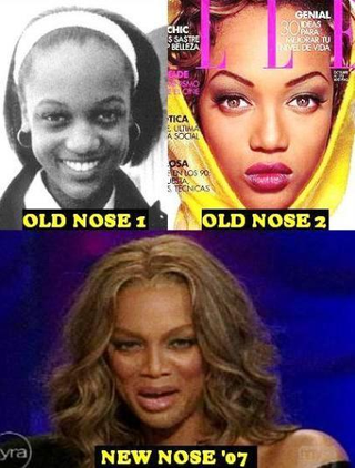 Illustration for article titled It's (Kinda) Settled: Tyra Banks Had A Nose Job